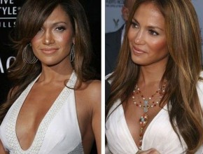 Jennifer Lopez before and after plastic surgery 06