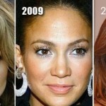 Jennifer Lopez before and after plastic surgery 07