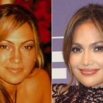 Jennifer Lopez before and after plastic surgery 10