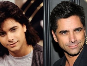 John Stamos before and after plastic surgery