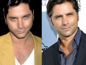 John Stamos before and after plastic surgery 02
