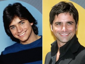 John Stamos before and after plastic surgery