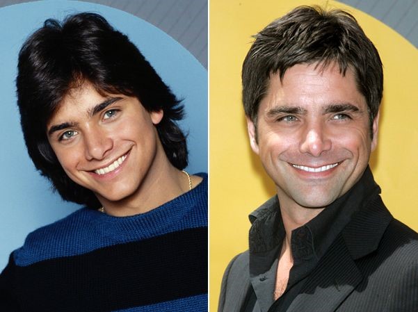 John Stamos before and after plastic surgery