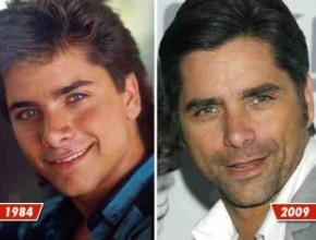 John Stamos before and after plastic surgery 06