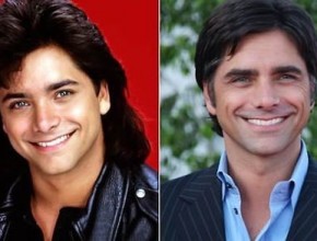 John Stamos before and after plastic surgery 07