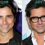 John Stamos before and after plastic surgery 08