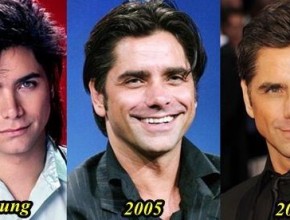 John Stamos before and after plastic surgery 09