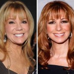Kathie Lee Gifford before and after plastic surgery 01
