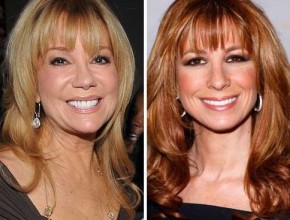 Kathie Lee Gifford before and after plastic surgery 01