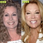 Kathie Lee Gifford before and after plastic surgery 02