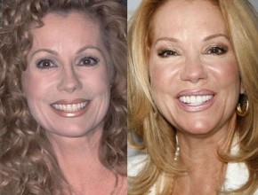 Kathie Lee Gifford before and after plastic surgery 02