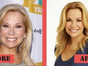 Kathie Lee Gifford before and after plastic surgery 06