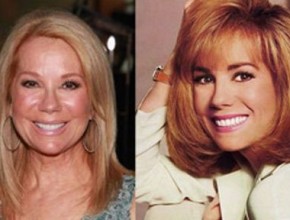 Kathie Lee Gifford before and after plastic surgery 07