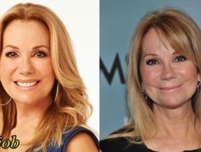 Kathie Lee Gifford before and after plasticnose job 01