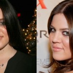 Khloe Kardashian before and after plastic surgery 01