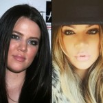 Khloe Kardashian before and after plastic surgery 02