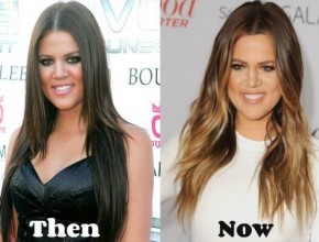 Khloe Kardashian before and after plastic surgery