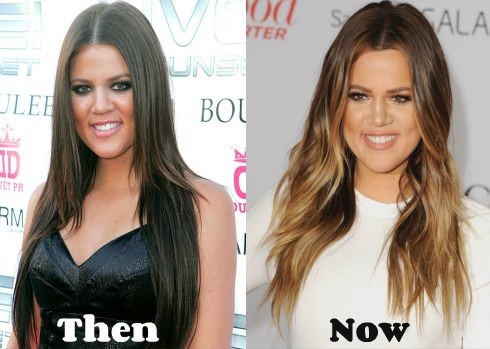 Khloe Kardashian before and after plastic surgery