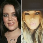 Khloe Kardashian before and after plastic surgery 05