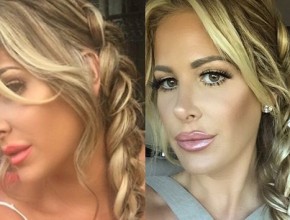 Kim Zolciak after nose job 01