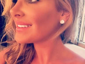 Kim Zolciak after nose job 05