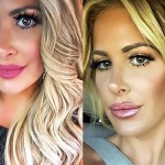 Kim Zolciak before and after nose job 01