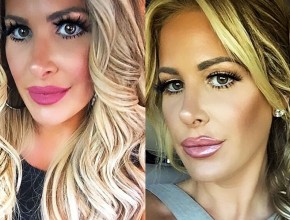 Kim Zolciak before and after nose job 01