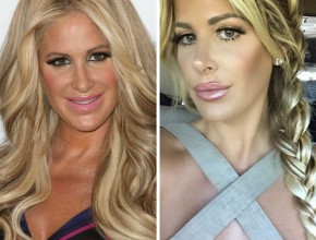 Kim Zolciak before and after nose job