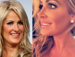 Kim Zolciak before and after nose job