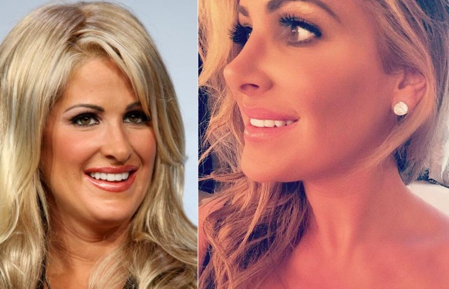 Kim Zolciak before and after nose job