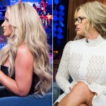 Kim Zolciak before and after plastic surgery 01