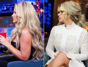 Kim Zolciak before and after plastic surgery 01