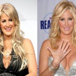 Kim Zolciak before and afterbreast augmentation 02