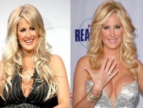 Kim Zolciak before and afterbreast augmentation 02