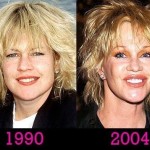 Melanie Griffith before and after plastic surgery 01