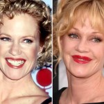 Melanie Griffith before and after plastic surgery 04