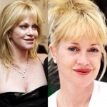 Melanie Griffith before and after plastic surgery 06
