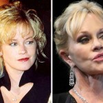 Melanie Griffith before and after plastic surgery 07
