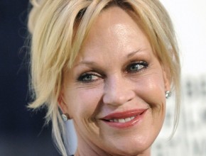 Melanie Griffith plastic surgery 01