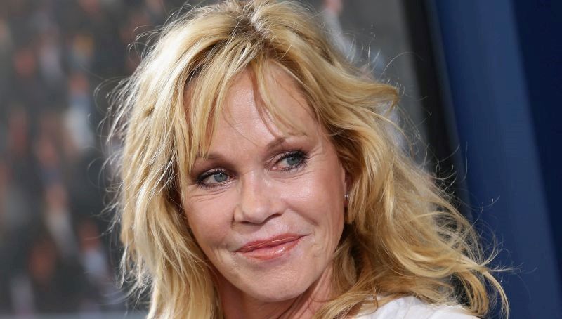 Melanie Griffith plastic surgery