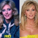 Morgan Fairchild before and after plastic surgery 01