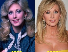 Morgan Fairchild before and after plastic surgery 01