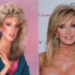 Morgan Fairchild before and after plastic surgery 02
