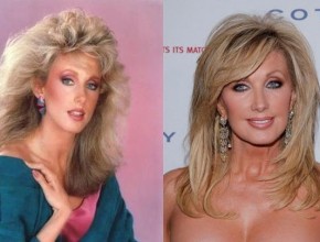 Morgan Fairchild before and after plastic surgery 02