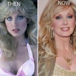 Morgan Fairchild before and after plastic surgery 03