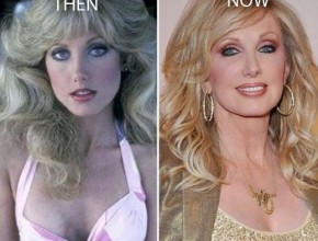 Morgan Fairchild before and after plastic surgery 03