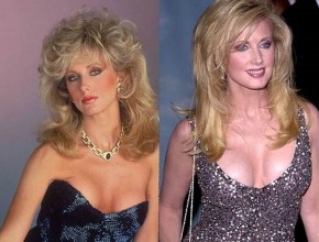 Morgan Fairchild before and after plastic surgery