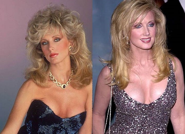 Morgan Fairchild before and after plastic surgery