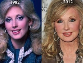 Morgan Fairchild before and after plastic surgery