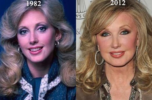 Morgan Fairchild before and after plastic surgery